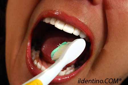 Malattia paradontale | ildentino.COM® Centro Dentistico Torino